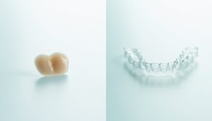 Ljuskice za zube ili aparatić: Što je bolji izbor za Vaš osmijeh u Zagrebu?